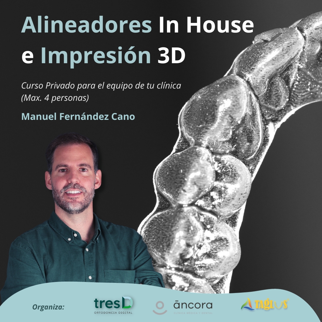 Alineadores In House e Impresión 3D