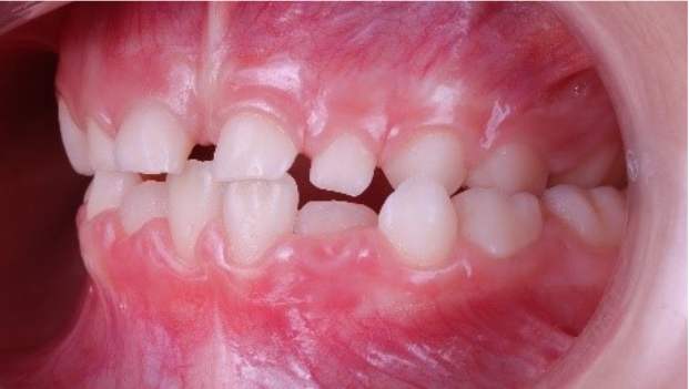 Ortopedia Dentofacial